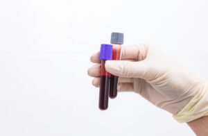 Pakiet kardiologiczny z krwi – klucz do zdrowego serca